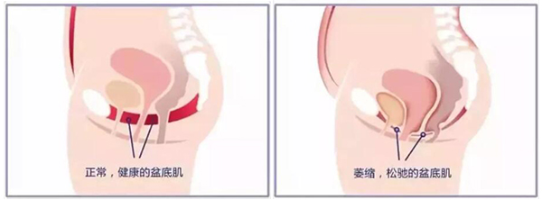 能进去一根手指是不是说明正常的