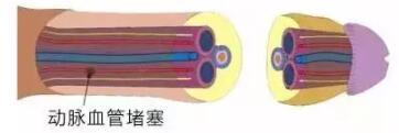 做着做着软了是什么原因