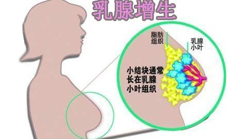 平时应该怎么预防乳腺疾病做哪些检查