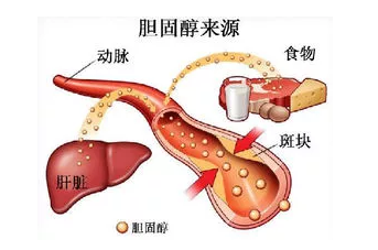 胆固醇高的食物有哪些