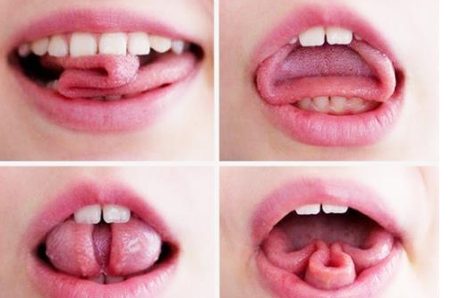 舌头边缘有齿痕是什么原因 